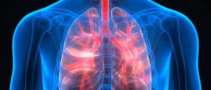 Lung Disease 