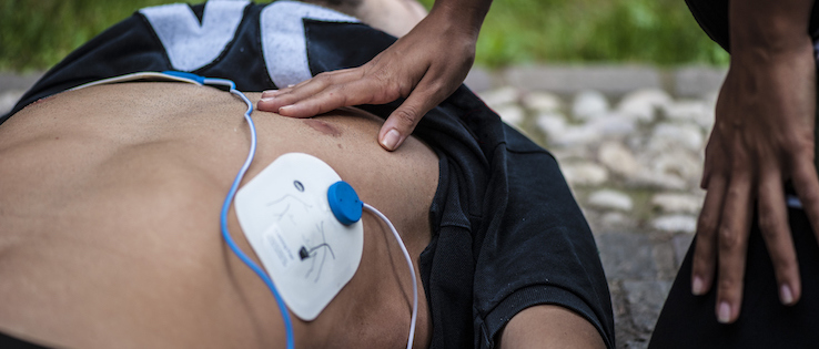 Defibrillators Save Lives - Myths Debunked