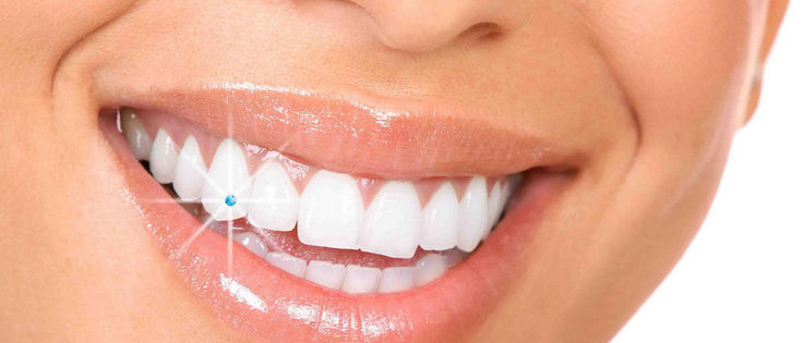 Dental Health Article by Dr Emma - "Fashionable Teeth"