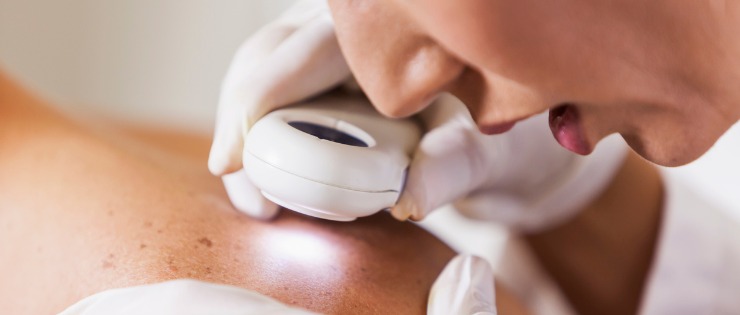 Dermatologist assessing patients skin for skin cancer